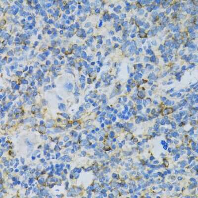 Immunohistochemistry-Paraffin: RPL13 Antibody - BSA Free [NBP2-94875]