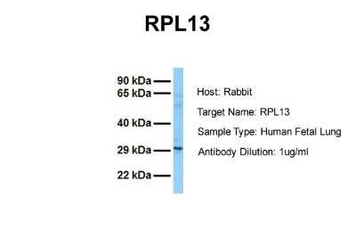 Western Blot: RPL13 Antibody [NBP1-57476]