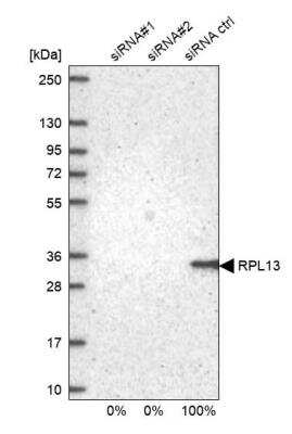 Western Blot: RPL13 Antibody [NBP2-13250]