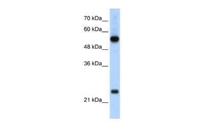 Western Blot: RPL13 Antibody [NBP2-88183]