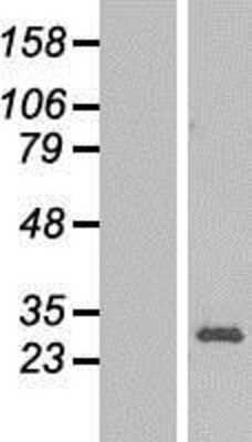 Western Blot: RPL13 Overexpression Lysate [NBL1-15504]