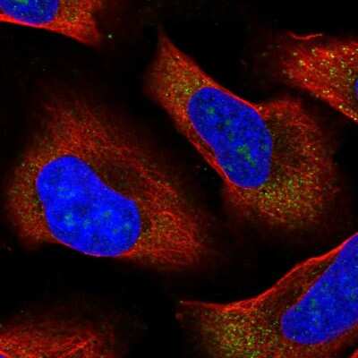 Immunocytochemistry/ Immunofluorescence: RPL13A Antibody [NBP1-92345]