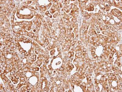 Immunohistochemistry-Paraffin: RPL13A Antibody [NBP1-32710]