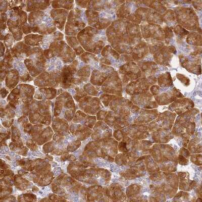 Immunohistochemistry-Paraffin: RPL13A Antibody [NBP1-92345]