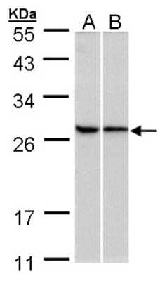 Western Blot: RPL13A Antibody [NBP1-32710]