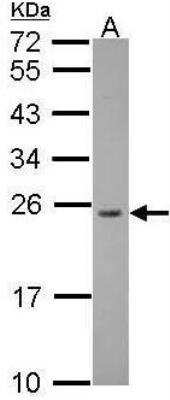 Western Blot: RPL13A Antibody [NBP1-32710]