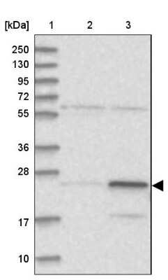 Western Blot: RPL13A Antibody [NBP1-92345]