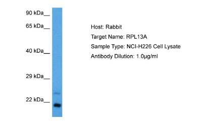 Western Blot: RPL13A Antibody [NBP2-88184]