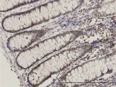 Immunohistochemistry-Paraffin: RPL14 Antibody (1B4) [H00009045-M01]