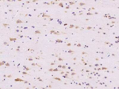 Immunohistochemistry-Paraffin: RPL14 Antibody [NBP2-97838]