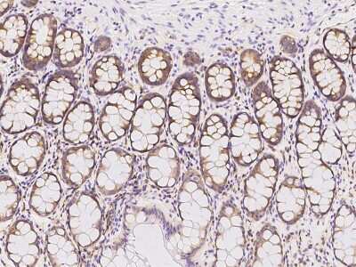 Immunohistochemistry-Paraffin: RPL14 Antibody [NBP2-97838]