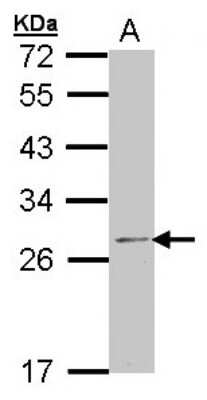 Western Blot: RPL14 Antibody [NBP1-33068]