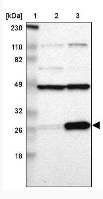 Western Blot: RPL14 Antibody [NBP1-85385]