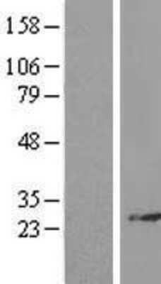 Western Blot: RPL14 Overexpression Lysate [NBL1-15506]