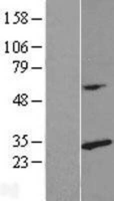 Western Blot: RPL14 Overexpression Lysate [NBL1-15507]