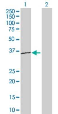 Western Blot: RPL15 Antibody [H00006138-D01P]