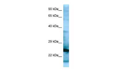 Western Blot: RPL15 Antibody [NBP2-86782]