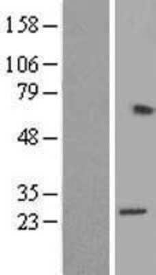 Western Blot: RPL15 Overexpression Lysate [NBL1-15508]