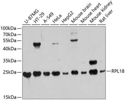 Western Blot: RPL18 AntibodyAzide and BSA Free [NBP2-94208]