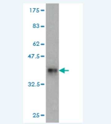 Western Blot: RPL18 Antibody (3D5) [H00006141-M01]