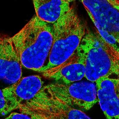 Immunocytochemistry/ Immunofluorescence: RPL18 Antibody [NBP2-13251]