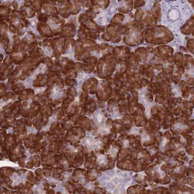 Immunohistochemistry-Paraffin: RPL18 Antibody [NBP2-13251]