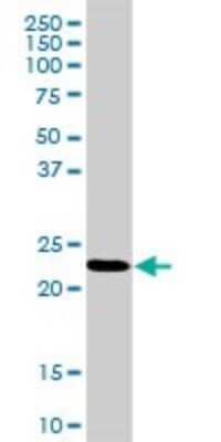 Western Blot: RPL18 Antibody [H00006141-D01P]