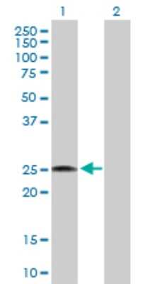 Western Blot: RPL18 Antibody [H00006141-D01P]