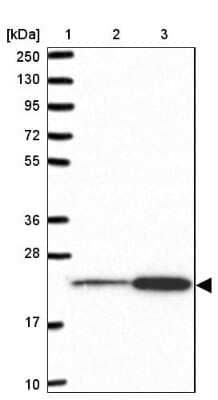 Western Blot: RPL18 Antibody [NBP2-13251]