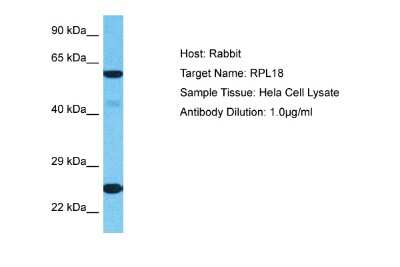 Western Blot: RPL18 Antibody [NBP2-88186]