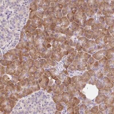 Immunohistochemistry: RPL18A Antibody [NBP2-30708]