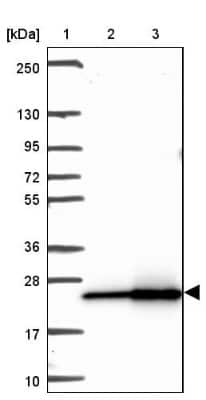 Western Blot: RPL18A Antibody [NBP2-30708]