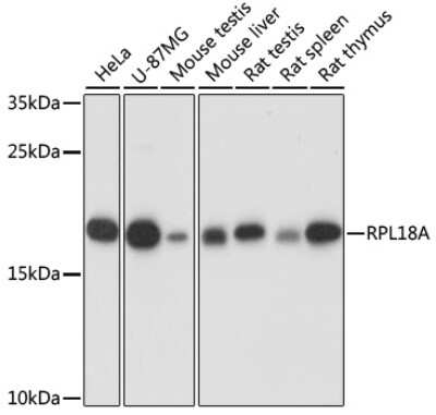 Western Blot: RPL18A AntibodyAzide and BSA Free [NBP2-94833]