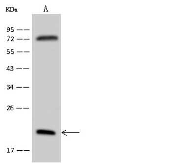 Western Blot: RPL18A Antibody [NBP2-97781]