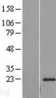 Western Blot: RPL18A Overexpression Lysate [NBL1-15512]