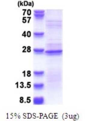 SDS-PAGE: Recombinant Human RPL18A His Protein [NBP2-51683]