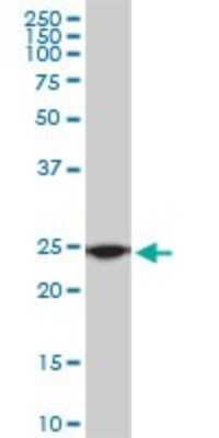 Western Blot: RPL19 Antibody (3H4) [H00006143-M01]