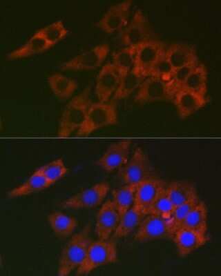 Immunocytochemistry/ Immunofluorescence: RPL19 Antibody - Azide and BSA Free [NBP3-16045]