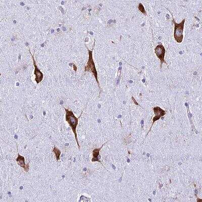 Immunohistochemistry-Paraffin: RPL19 Antibody [NBP1-92346]
