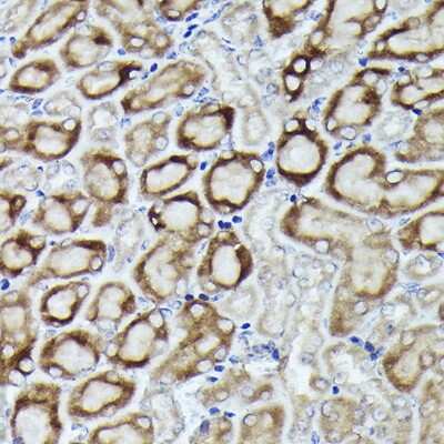 Immunohistochemistry-Paraffin: RPL19 Antibody - Azide and BSA Free [NBP3-16045]