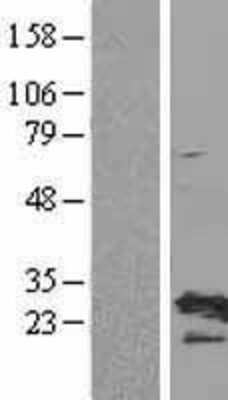 Western Blot: RPL19 Overexpression Lysate [NBL1-15513]