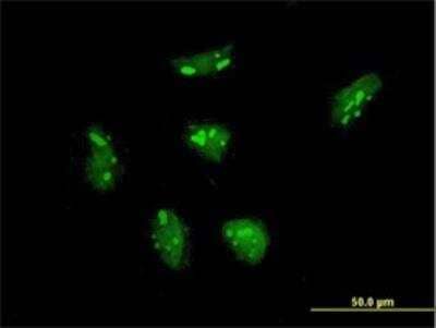 Immunocytochemistry/ Immunofluorescence: RPL21 Antibody (2D8) [H00006144-M03]