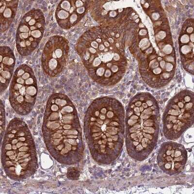 Immunohistochemistry-Paraffin: RPL21 Antibody [NBP2-13252]