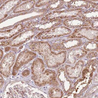 Immunohistochemistry-Paraffin: RPL21 Antibody [NBP2-13252]