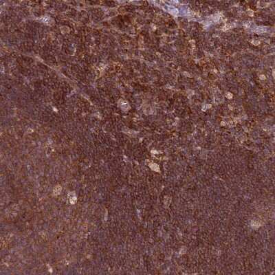 Immunohistochemistry-Paraffin: RPL21 Antibody [NBP2-13252]