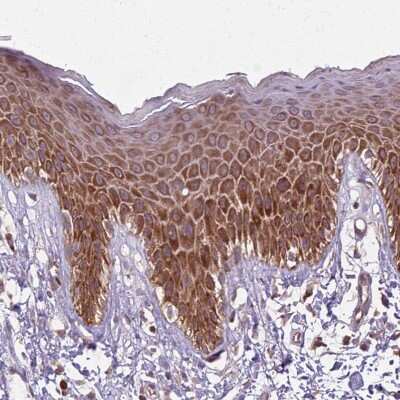 Immunohistochemistry-Paraffin: RPL21 Antibody [NBP2-13252]