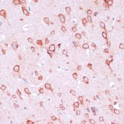 Immunohistochemistry-Paraffin: RPL21 Antibody - Azide and BSA Free [NBP2-93190]