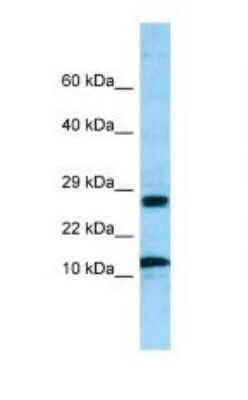 Western Blot: RPL21 Antibody [NBP1-98533]