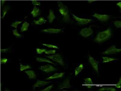 Immunocytochemistry/ Immunofluorescence: RPL21P44 Antibody (3E7) [H00402176-M03]