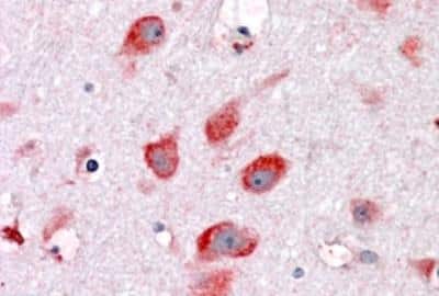 Immunohistochemistry-Paraffin: RPL22 Antibody [NBP1-06069]